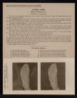 Lower Limb. Sole of Foot - no. 1